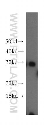 MTIF3 Antibody in Western Blot (WB)