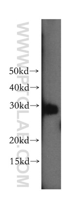 MTIF3 Antibody in Western Blot (WB)