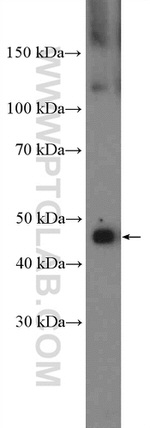 NFKB1 p105/p50 Antibody in Western Blot (WB)