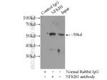 NFKB1 p105/p50 Antibody in Immunoprecipitation (IP)