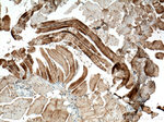 ACTN2 Antibody in Immunohistochemistry (Paraffin) (IHC (P))