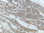 ACTN2 Antibody in Immunohistochemistry (Paraffin) (IHC (P))