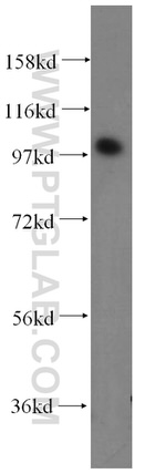 ACTN2 Antibody in Western Blot (WB)