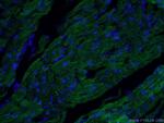 ACTN2 Antibody in Immunohistochemistry (PFA fixed) (IHC (PFA))