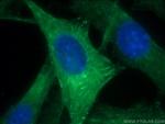 ACTN2 Antibody in Immunocytochemistry (ICC/IF)