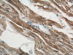 ACTN2 Antibody in Immunohistochemistry (Paraffin) (IHC (P))