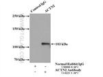 ACTN2 Antibody in Immunoprecipitation (IP)