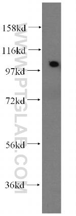 ACTN2 Antibody in Western Blot (WB)