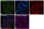 P-Cadherin Antibody in Immunocytochemistry (ICC/IF)