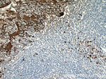 S100A9 Antibody in Immunohistochemistry (Paraffin) (IHC (P))