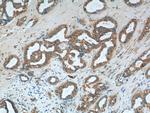 S100A9 Antibody in Immunohistochemistry (Paraffin) (IHC (P))