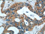 S100A9 Antibody in Immunohistochemistry (Paraffin) (IHC (P))