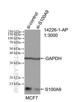 S100A9 Antibody in Western Blot (WB)