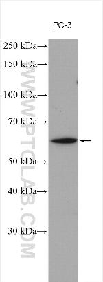 STXBP4 Antibody in Western Blot (WB)