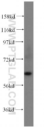 STXBP4 Antibody in Western Blot (WB)