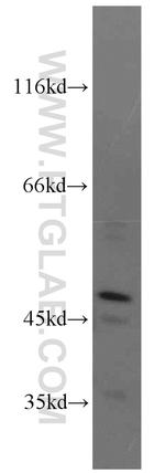 NEK2 Antibody in Western Blot (WB)