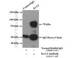 Kv1.2 Antibody in Immunoprecipitation (IP)