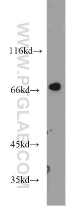 Kv1.2 Antibody in Western Blot (WB)