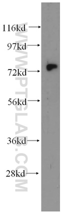 Kv1.2 Antibody in Western Blot (WB)
