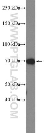 DUSP16 Antibody in Western Blot (WB)