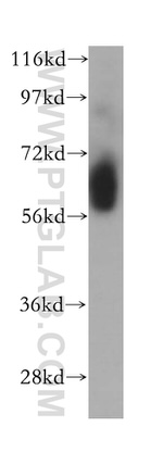 Myocilin Antibody in Western Blot (WB)