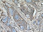 SUCLG2 Antibody in Immunohistochemistry (Paraffin) (IHC (P))