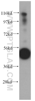 SUCLG2 Antibody in Western Blot (WB)