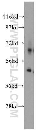 SUCLG2 Antibody in Western Blot (WB)