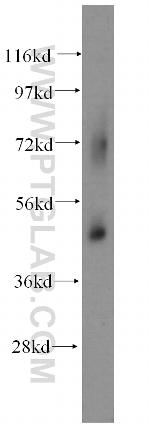 SUCLG2 Antibody in Western Blot (WB)