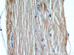 GCLM Antibody in Immunohistochemistry (Paraffin) (IHC (P))