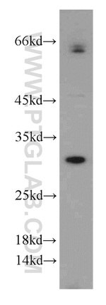 GCLM Antibody in Western Blot (WB)