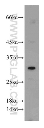 GCLM Antibody in Western Blot (WB)