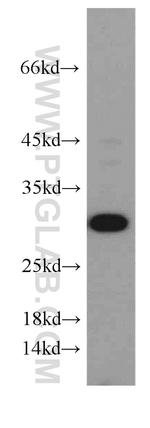 GCLM Antibody in Western Blot (WB)