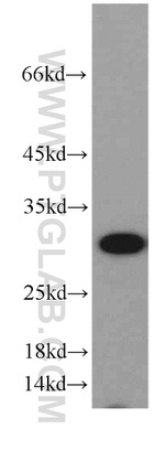 GCLM Antibody in Western Blot (WB)