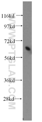 PIAS4 Antibody in Western Blot (WB)