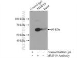 MMP19 Antibody in Immunoprecipitation (IP)