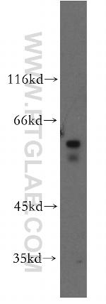 MMP19 Antibody in Western Blot (WB)