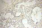 BIN2 Antibody in Immunohistochemistry (Paraffin) (IHC (P))