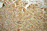 NR2E3 Antibody in Immunohistochemistry (Paraffin) (IHC (P))