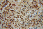NR2E3 Antibody in Immunohistochemistry (Paraffin) (IHC (P))