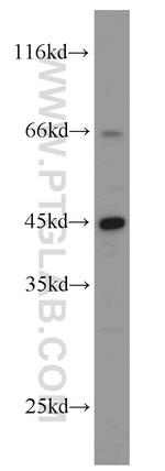 NR2E3 Antibody in Western Blot (WB)