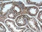 MSRB3 Antibody in Immunohistochemistry (Paraffin) (IHC (P))