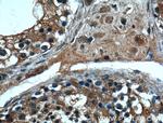 MSRB3 Antibody in Immunohistochemistry (Paraffin) (IHC (P))