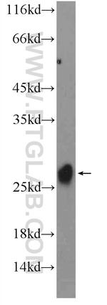 MSRB3 Antibody in Western Blot (WB)