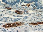 NCAM1/CD56 Antibody in Immunohistochemistry (Paraffin) (IHC (P))