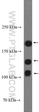 NCAM1/CD56 Antibody in Western Blot (WB)