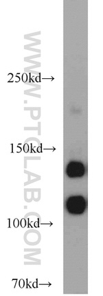 NCAM1/CD56 Antibody in Western Blot (WB)