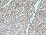 MTP18 Antibody in Immunohistochemistry (Paraffin) (IHC (P))