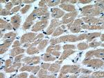 MTP18 Antibody in Immunohistochemistry (Paraffin) (IHC (P))