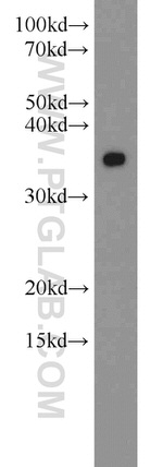 MBD3 Antibody in Western Blot (WB)